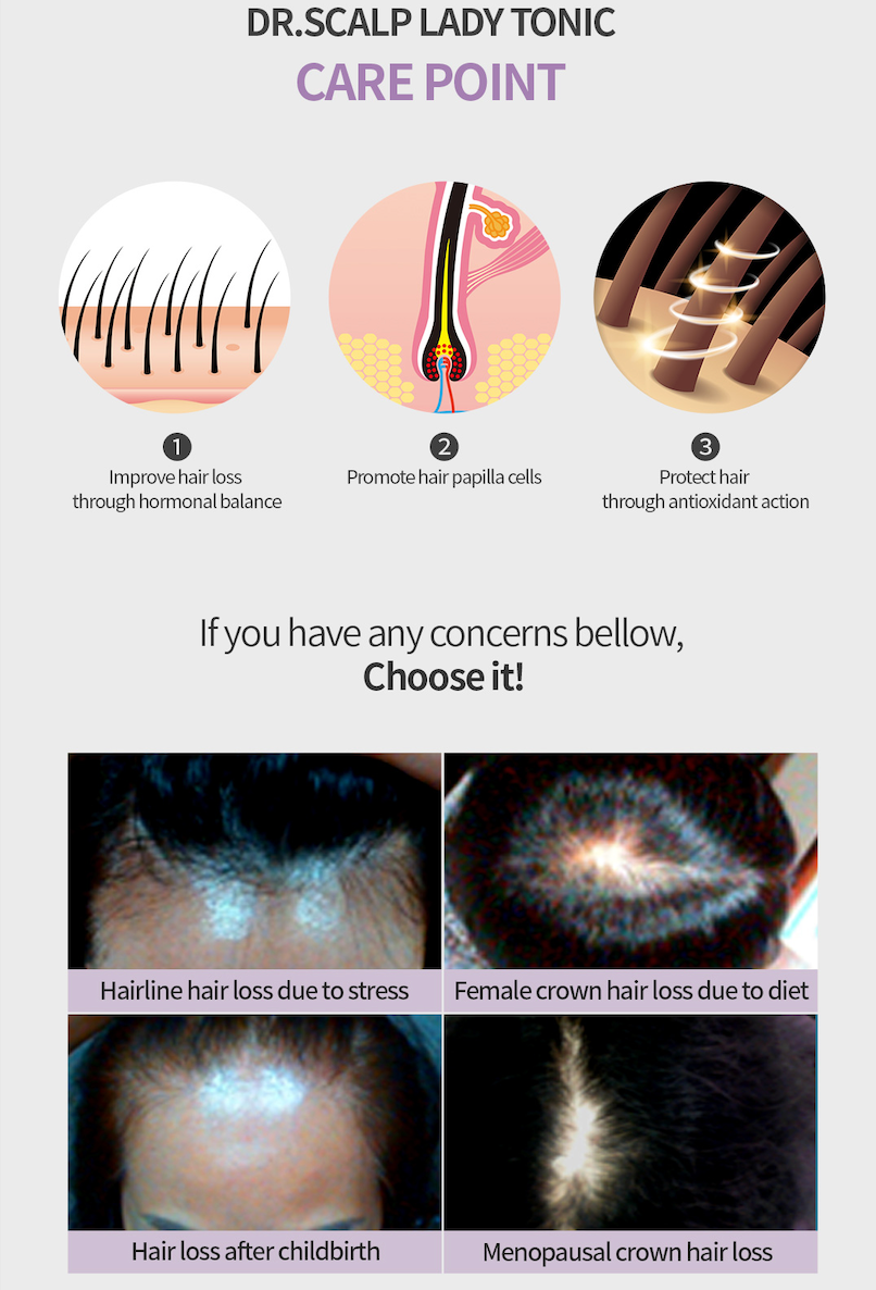 Best Hair Tonic For Hair  Loss Australia