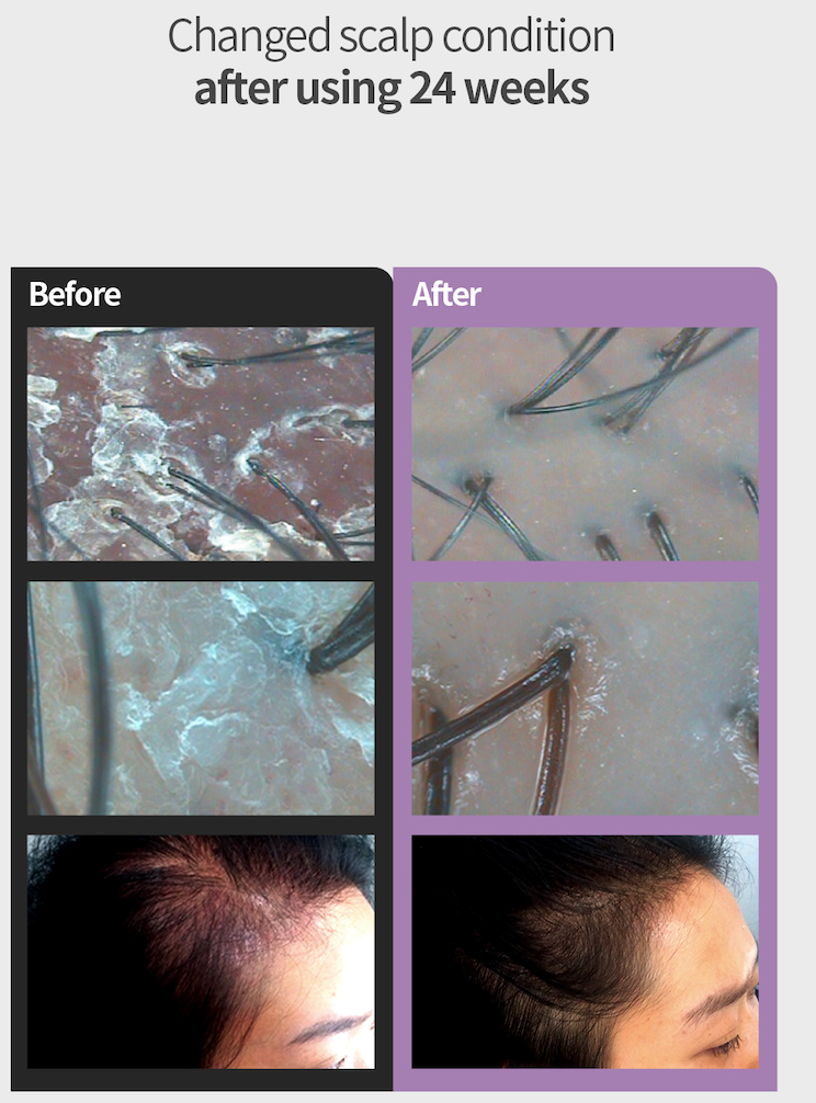Best Hair Tonic For Women Online Australia