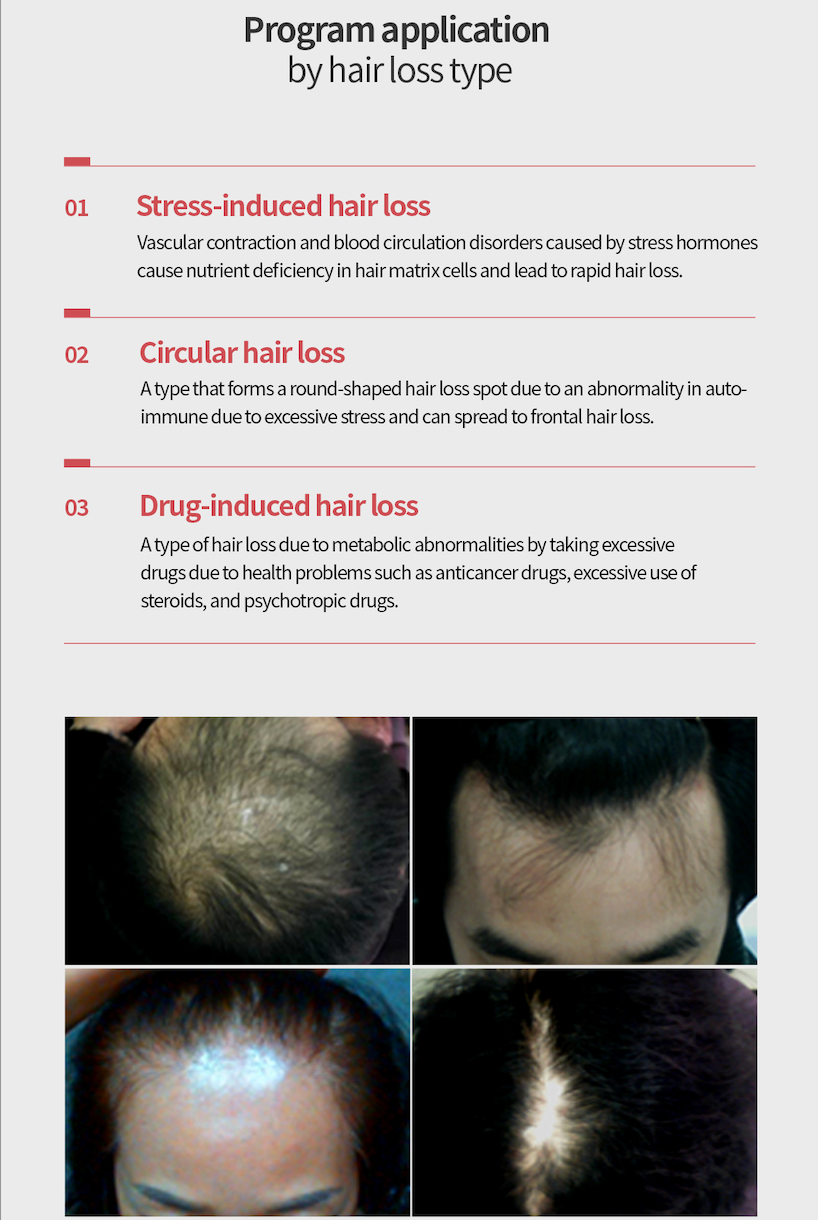 Dr.Scalp PRO Matrix Ampoule Serum - Copper Peptide Scalp Serum for Men & Women